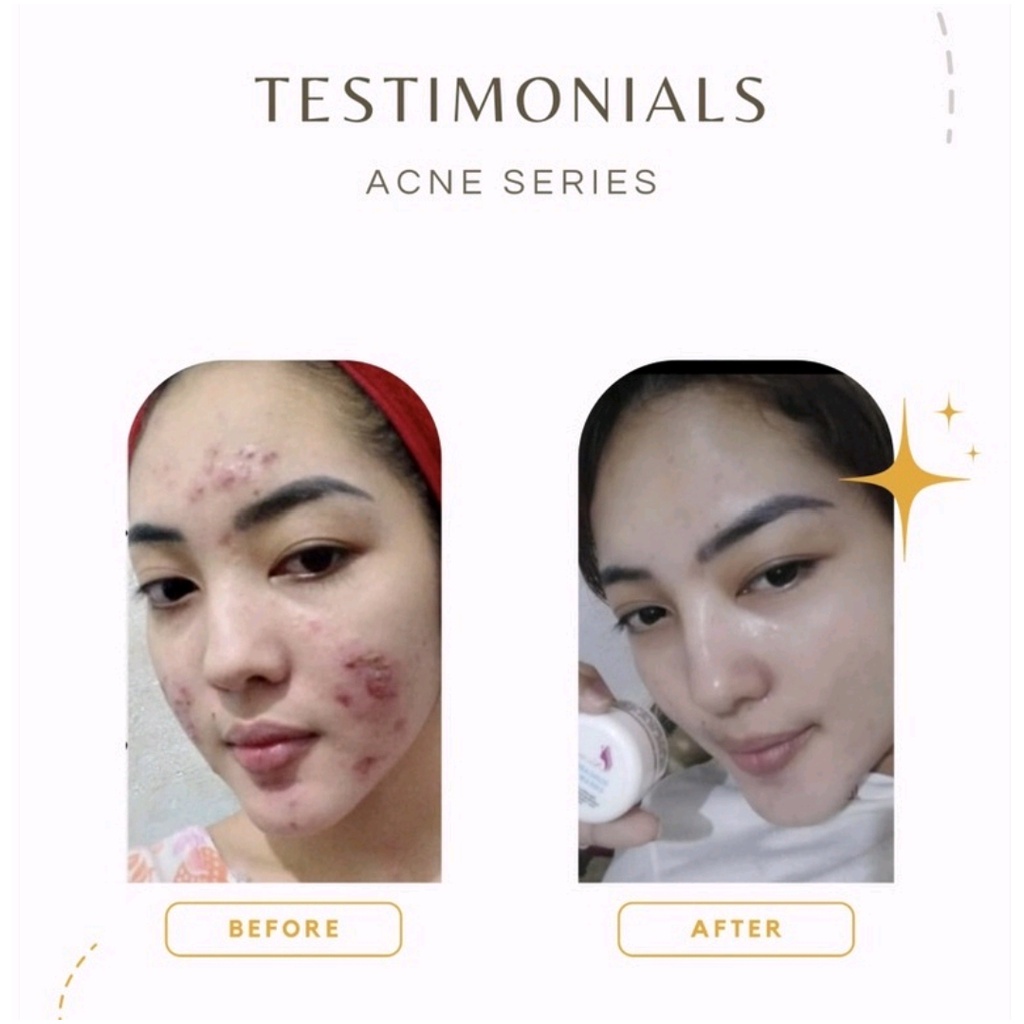 Nahda skincare-4