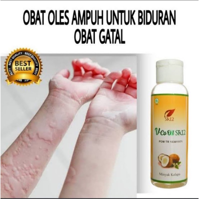SR12 - OBAT KALIGATA AMPUH - OBAT BIDURAN BPOM