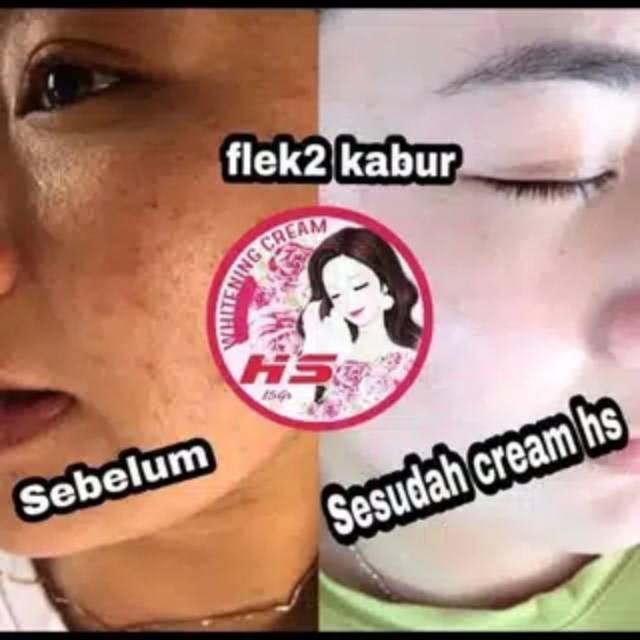 HS CREAM WHITENING ORIGINAL 100%