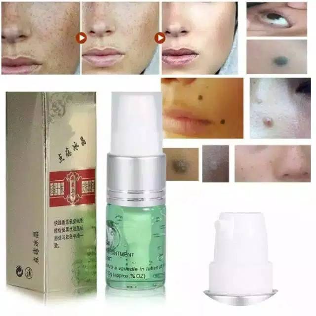 Serum repair pasca laser picosecond laser penghilang flek tai lalat kutil