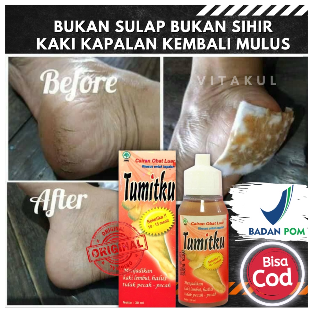 Tumitku Obat Herbal Kaki Pecah BPOM Original Asli Solusi Kaki Pecah Kapalan Obat Kaki Kapalan 30ml P