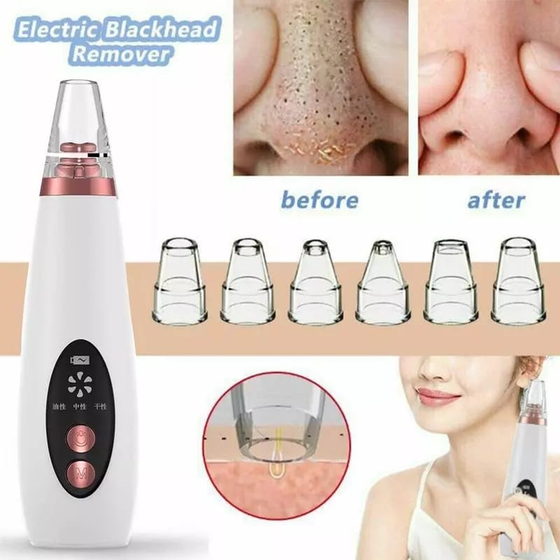 Facial Pore Cleaner Komedo Remover Vacuum Suction Cleaner Pori Jerawat Komedo