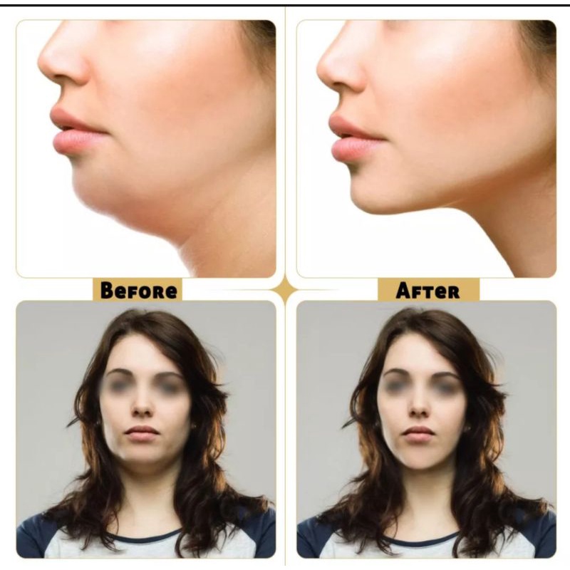 MASKER V SHAPE PENIRUS WAJAH