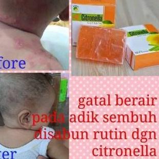 ֍ Sabun Citronella 80 gram Sabun Bidoyi Citronella Original ♚