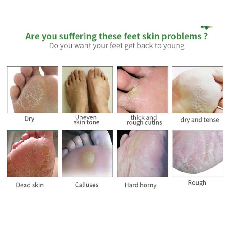 Efero Exfoliating Baby Foot Mask Masker Kaki Peeling Lavender &amp; Aloevera Membuat Sel Kulit Mati Rontok Semua