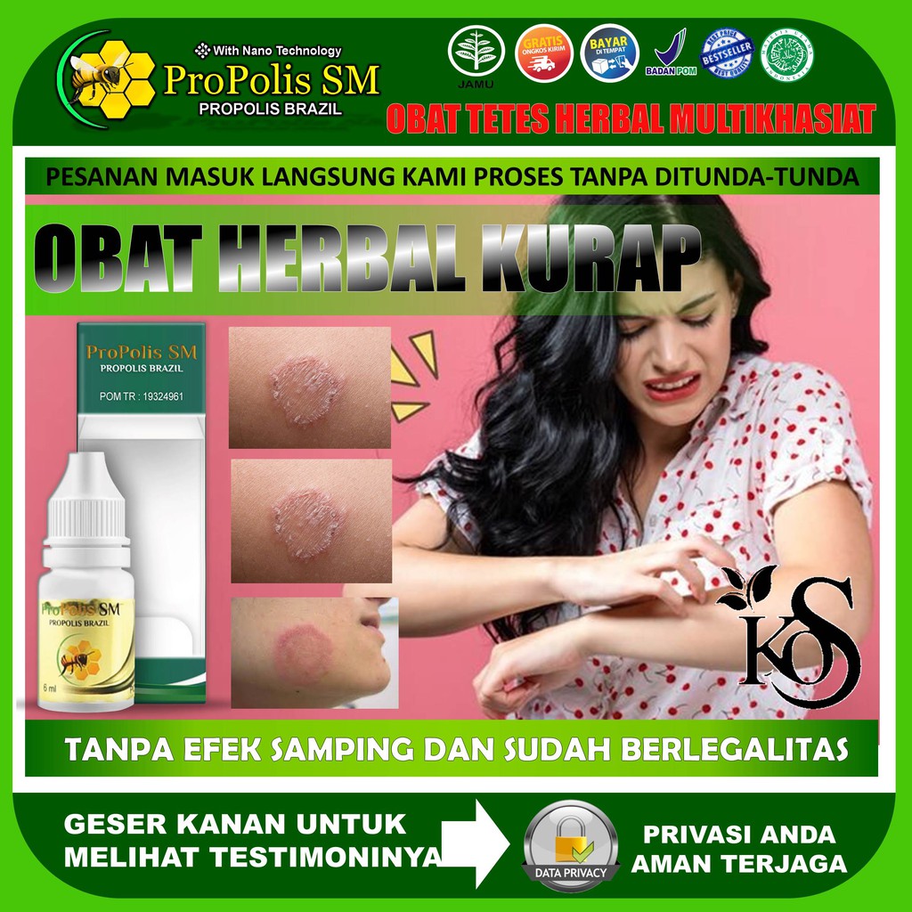 Obat Kurap obat Penghilang Panu Kurap Kudis Eksim Gatal Gatal Hapur Alergi Dengan Propolis SM Brazil