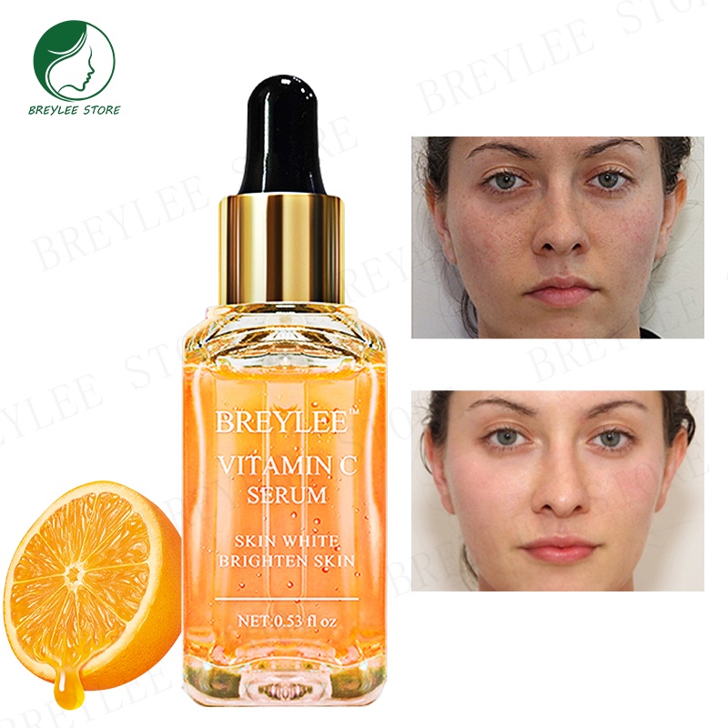 BREYLEE SETS of SERUM VITAMIN C SERUM+PORE MINIMIZER - Mencerahkan &amp; Membersihkan Jerawat (2pcs)