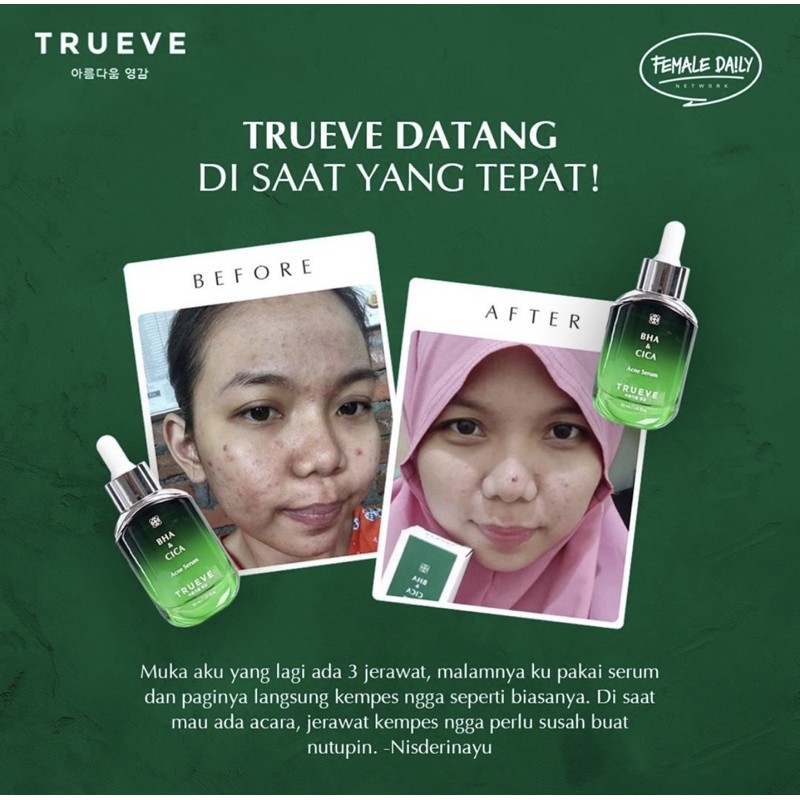 Review trueve bha & cica acne serum