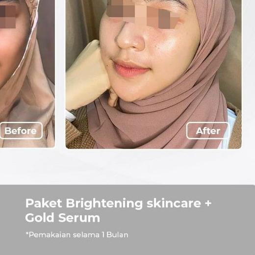 ◘ BENINGS SKINCARE DR OKY PRATAMA PAKET EXLUSIVE BRIGHTENING ACNE | BENINGS CLINIC | BENING'S SKINCA