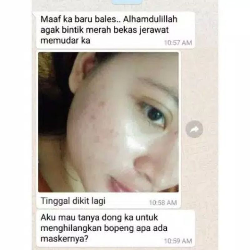MASKER CHITIN CHITOSAN SOLUSI KULIT BOPENG, BERJERAWAT DAN PENGHILANG FLEK HITAM-4