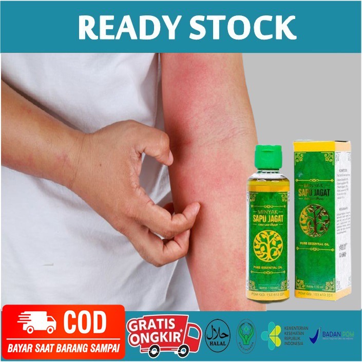 Minyak Oles Sapu Jagat - Untuk Meredakan bentol gatal di tangan, kaki, badan, alergi gatal gatal
