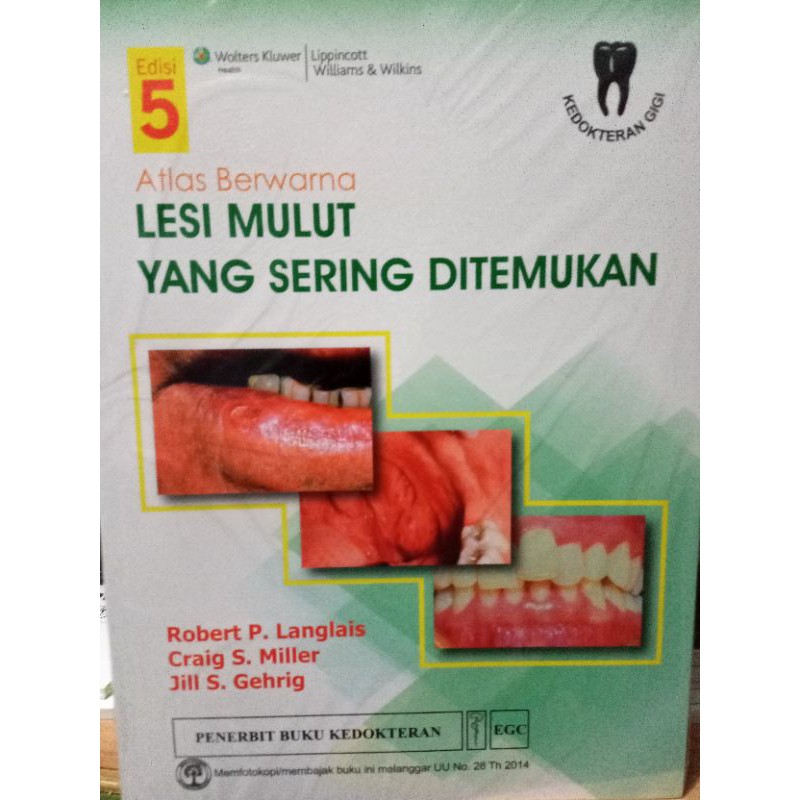 Atlas Berwarna Lesi Mulut yang Sering Ditemukan Edisi 5