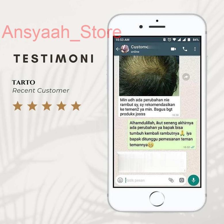 [KODE 5826] SNOWELA Hair Serum Treatment Essence 100% Original BPOM Serum Penumbuh dan Penyubur Ramb