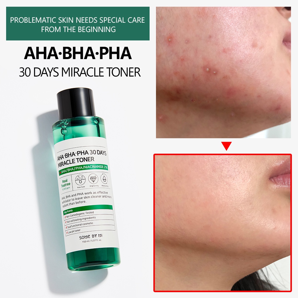 SOMEBYMI-AHA-BHA-PHA 30 Days Miracle Toner 150mL | SOME BY MI