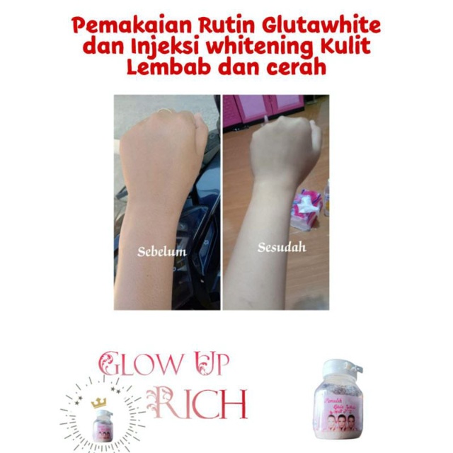 susu gluta white kfs