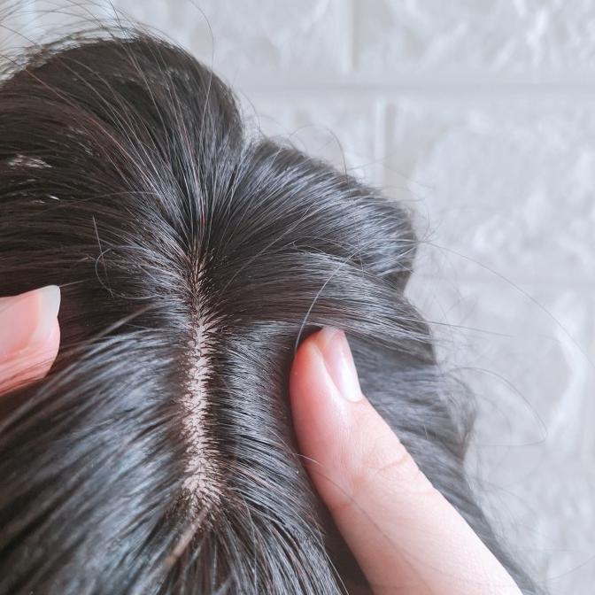 SKIN HUMAN HAIR TOPPER - toupee human hair - penutup botak murah ---Terbaru---