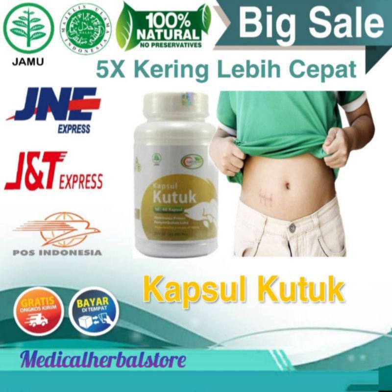 Jual Kapsul Kutuk Premium Asli 100 % Original Cepat Mengeringkan Luka ...