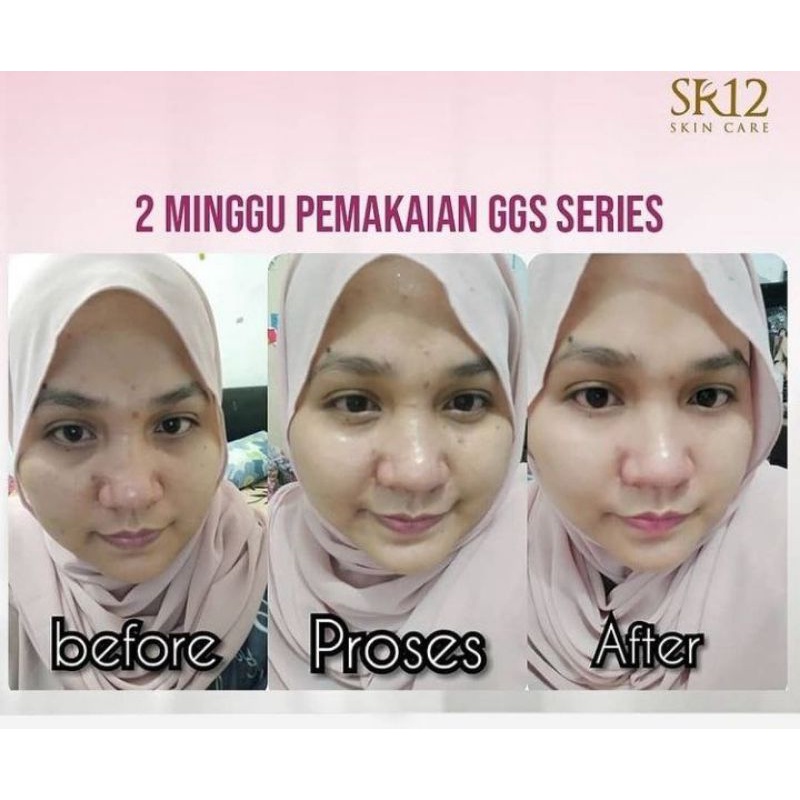 GGS SERIES SR12 GLOW GLASS SKIN - KRIM PENCERAH WAJAH CEPAT DAN AMAN