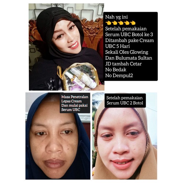 UBC SKINCARE UMI AL-FATIH UMI BEAUTY CARE VIRAL SEKALI OLES GLOWING