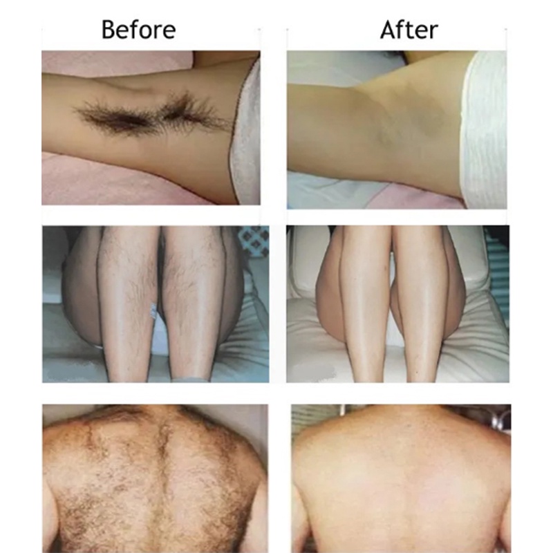 Krim Cream Penghilang bulu permanen rambut Rambut ketiak  Bagian privat kaki Lengan Hair removal cream cepat yang aman, lembut, tanpa rasa sakit, dan tidak menyebabkan iritasi