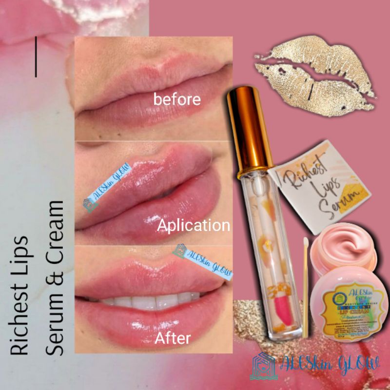 Lips Serum Cream Pemerah Bibir Pelembab Pencerah Bibir Hitam Lip Balm Lips Care Richest by Aleskin Glow