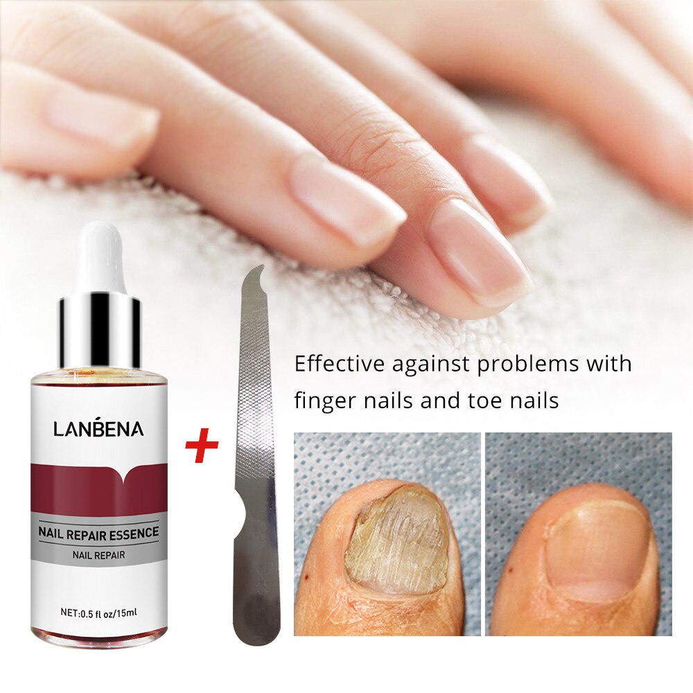 ORIGINAL Lanbena Kuku Perbaikan Essence Serum Jamur Perawatan Kuku