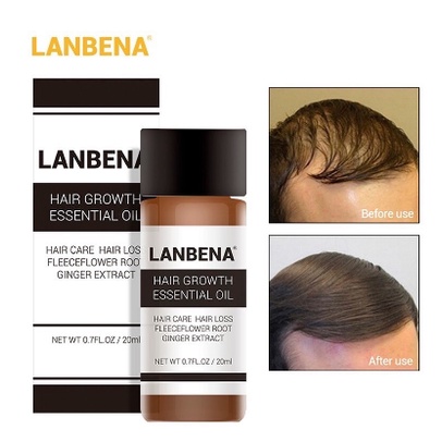 Lanbena Hair Growth Serum / Lanbena Serum Penumbuh Rambut Herbal