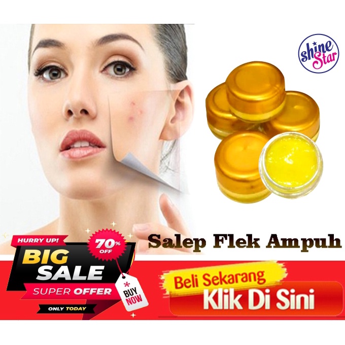 SHINE STAR - Salep Flek Hitam Melasma Ampuh / Salep Wajah Menghilangkan Flex Hitam Dan Jerawat