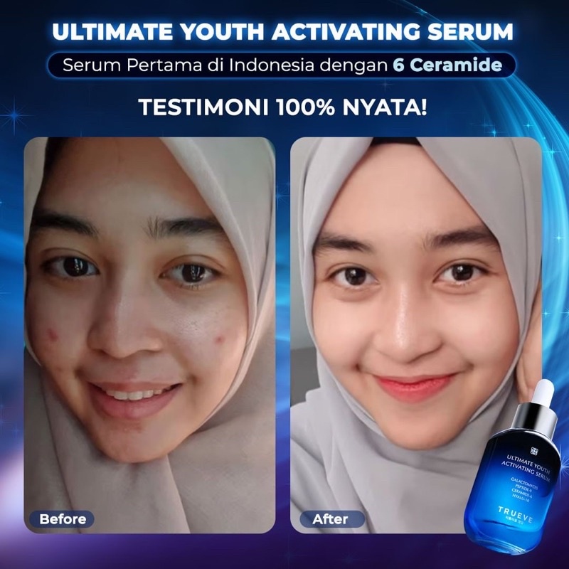 TRUEVE Ultimate Youth Activating Serum (Anti Aging Serum,Pemutih Wajah, Serum Glowing, Flek Hitam)