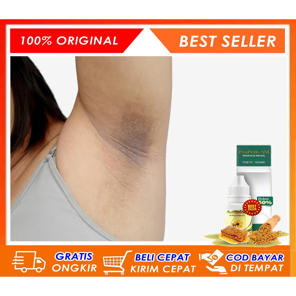 Obat Pemutih Ketiak Hitam, Penghilang Ketiak Hitam Paling Terlaris, Obat Ketiak Hitam - Propolis SM