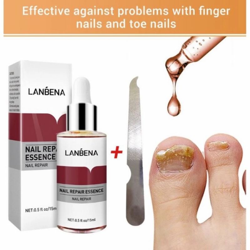 Lanbena Nail Repair Essence [Gratis Alat Kikir Kuku] / Lanbena Perawatan Kuku Kaki &amp; Tangan / Lanbena Serum Perawatan Kuku / Lanbena Oil Serum Nail Treatment / Lanbena Perawatan Kuku Esensi Serum Jamur Kuku / Serum Perawatan Jamur Kuku Pecah Kasar