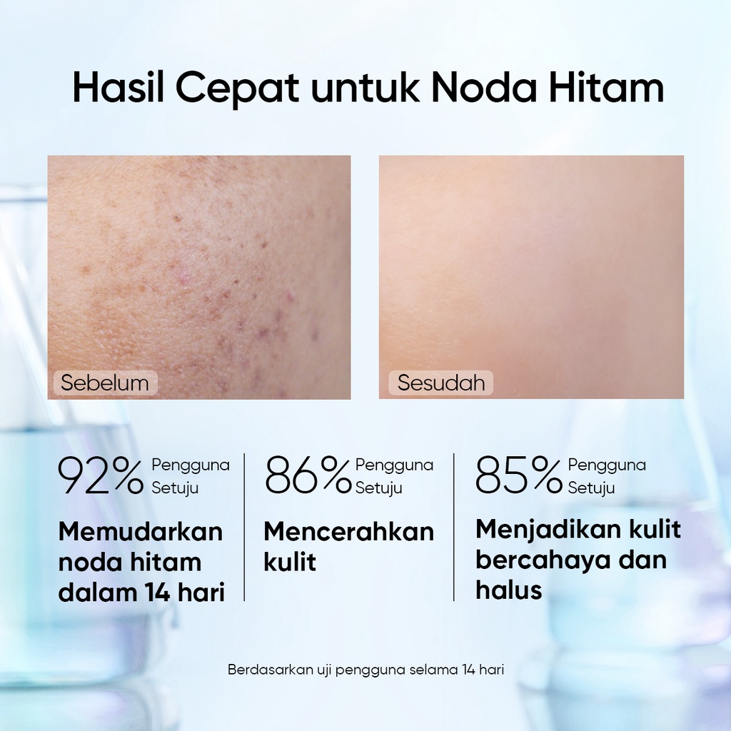 SKINTIFIC SymWhite 377 Dark Spot Serum