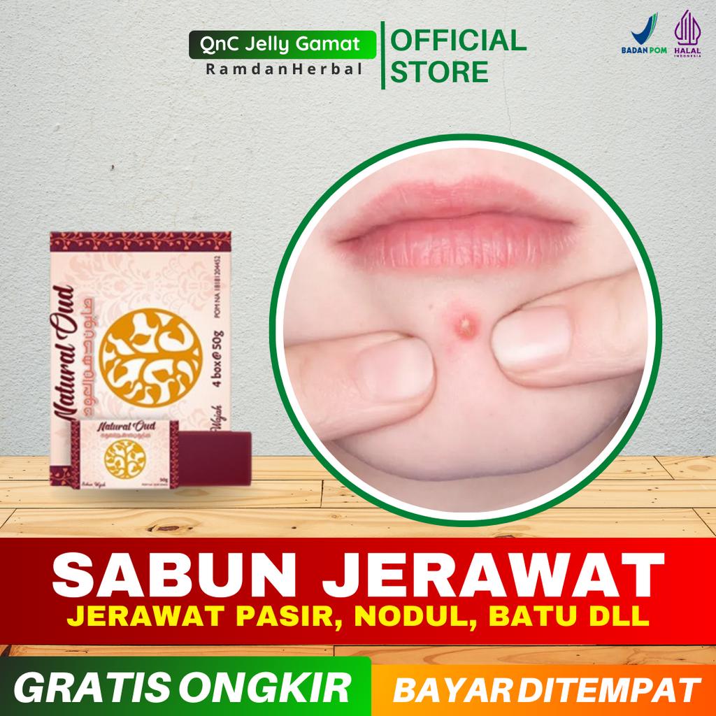 Sabun Jerawat Natural Oud Jerawat Batu Pasir Nodul Pustula Di Dahi Dagu Pipi Kening Hidung