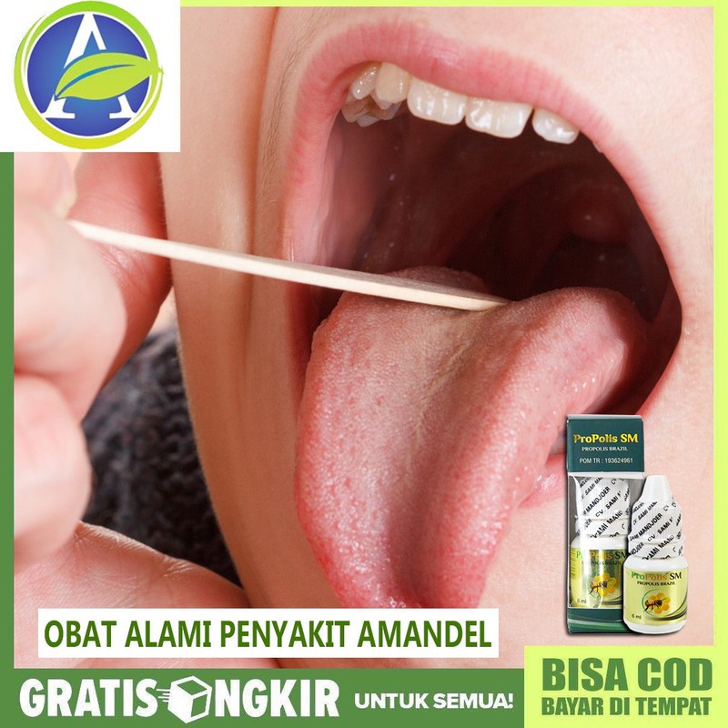 

Obat Amandel, Radang Amandel, radang tenggorokan Herbal Terlaris Dengan Propolis SM ASLI