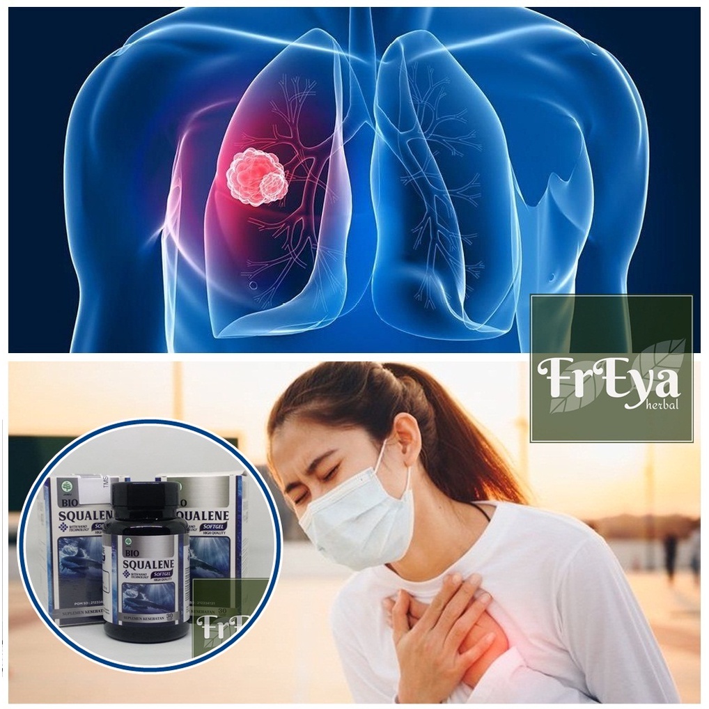 OBAT BENJOLAN DI PARU PARU, OBAT TUMOR DI PARU PARU (BISA COD)