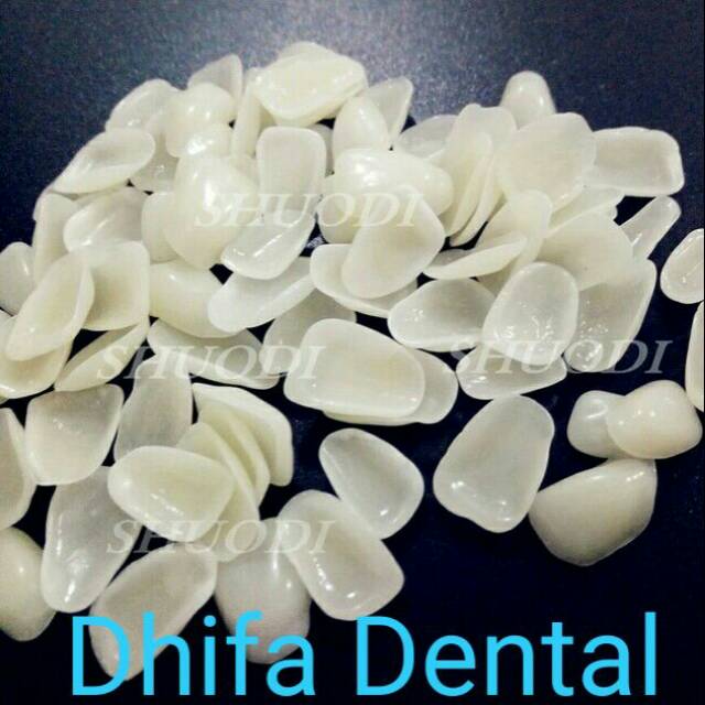 1 Pack Crown Gigi Veneer indirect