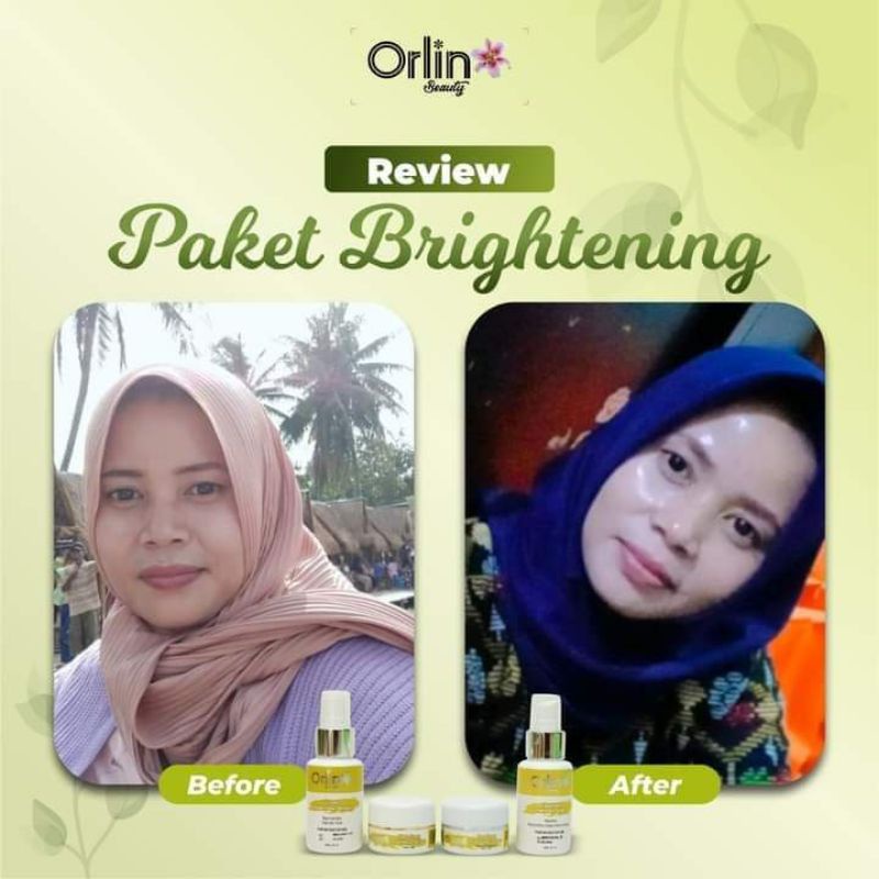 krim pemutih wajah bpom/orlin whetening platinum/ampuh mengatasi kulit wajah dalam 10 hari