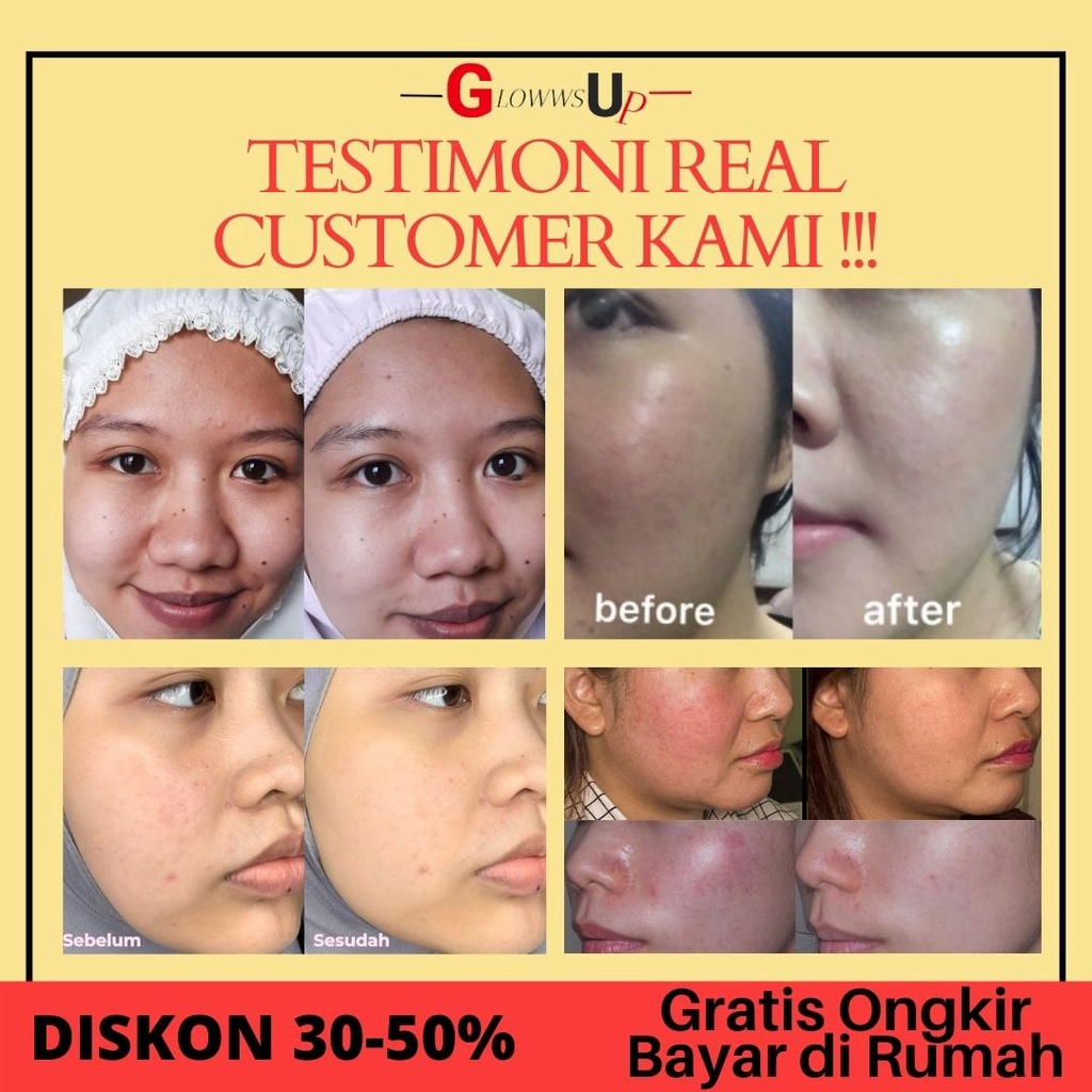 Serum Wajah Anti acne SOMETHINC Holyshield Sunscreen Comfort Corrector Serum SPF 50+ - 15ml Perawatan Wajah