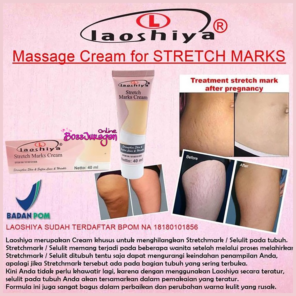 (BOSS) Laoshiya stretch mark cream BPOM SH cosmetics