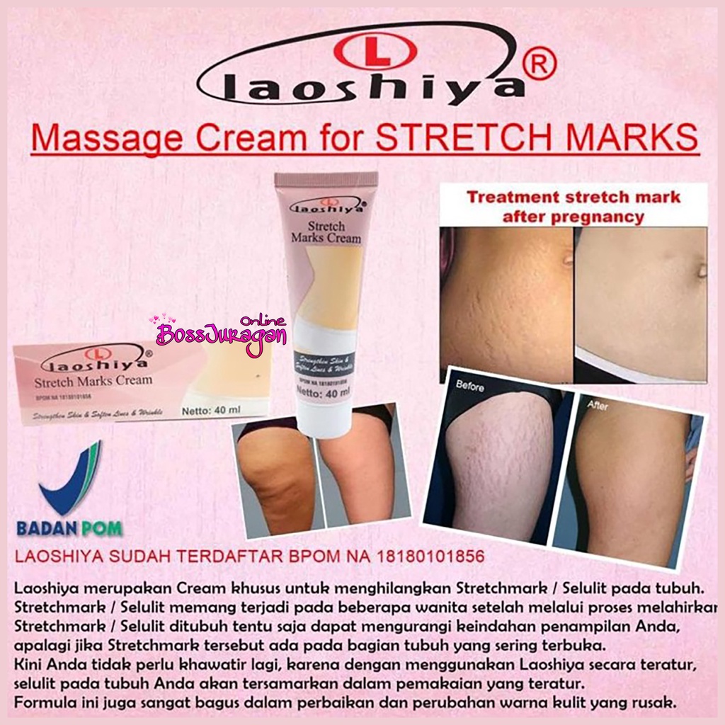 (BOSS) Laoshiya stretch mark cream BPOM SH cosmetics