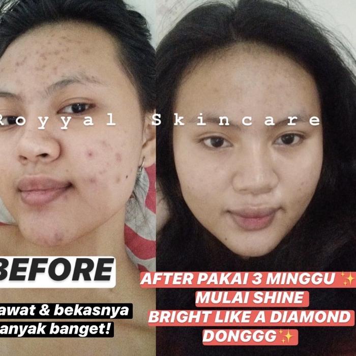 Miliki - WHITENING NIGHT CREAM  CREAM PEMUTIH WAJAH - Royyal Skincare