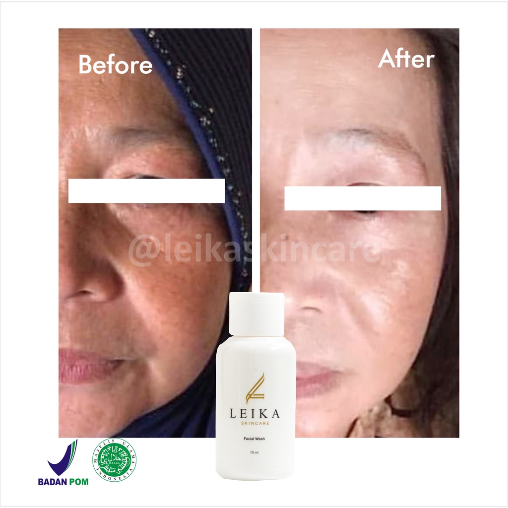 Wow! Sabun Muka Anti Aging Paling Ampuh Sabun Anti Penuaan Dini Asli Halal BPOM Facial Wash Leika Skincare 70ml Sabun Penghilang Kerutan di Wajah Original