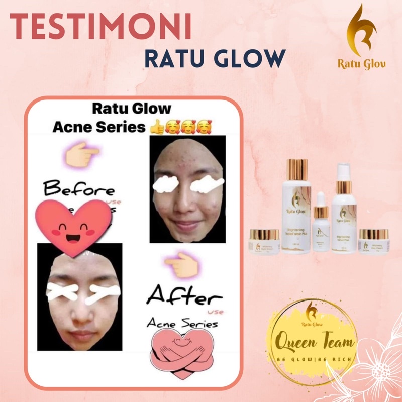 RATU GLOW SKINCARE ORIGINAL PAKET BRIGHTENING DAN ACNE PEMUTIH WAJAH GLOWING PENGHILANG JERAWAT PENGHILANG FLEK-5