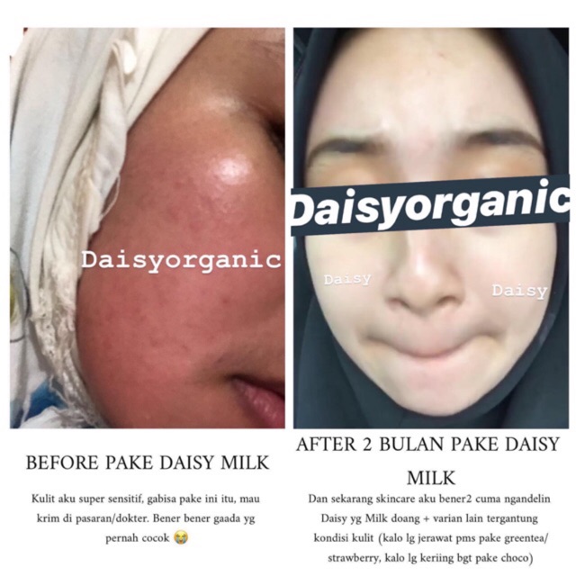 Daisy Organic Milk Facemask Masker Face Mask BPOM Original