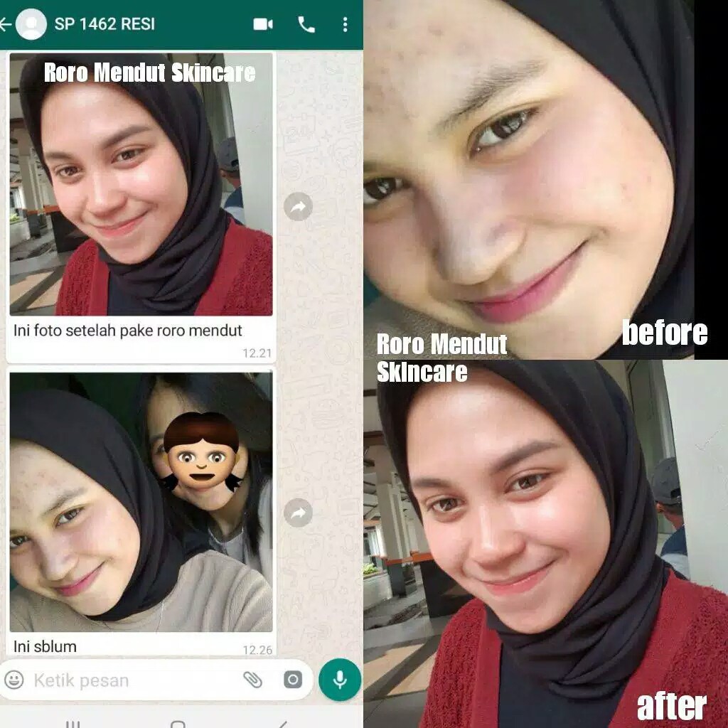 Roro Mendut Starter Rempah Hitam Whitening