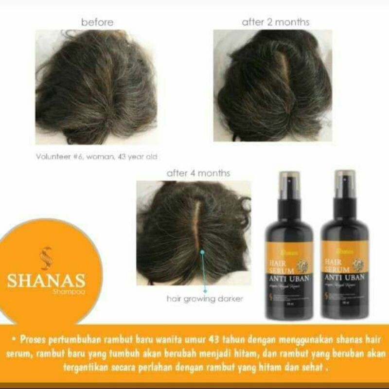 TERLARIS..PENGHITAM UBAN SERUM ANTI UBAN(MENGATASI RAMBUT BERUBAN)
