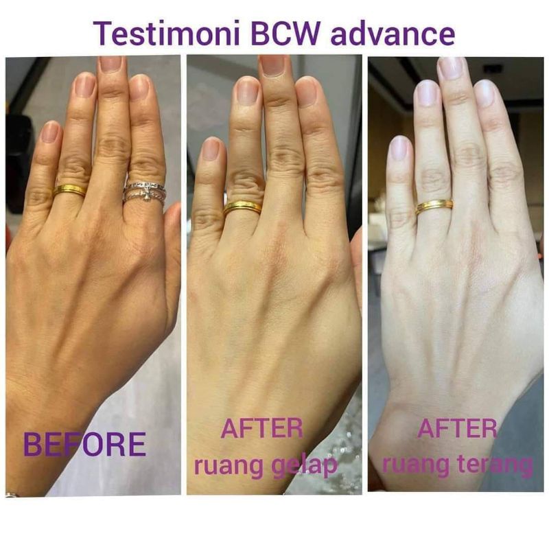 BCW ADVANCE (Booster C Whitening)