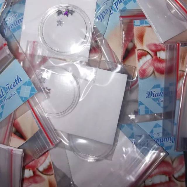 Diamond Gigi Salovakia Bintang, Permata Gigi Behel Bintang