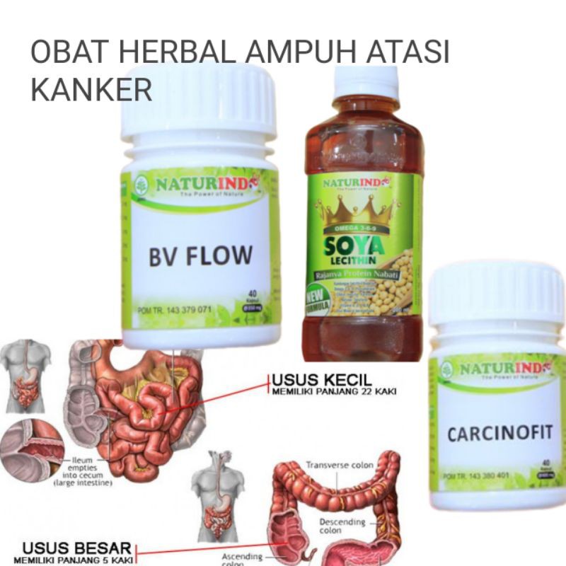 ObatHerbal Kanker Usus Herbal Atasi Kanker usus Kanker Usus parah Obat Kanker
