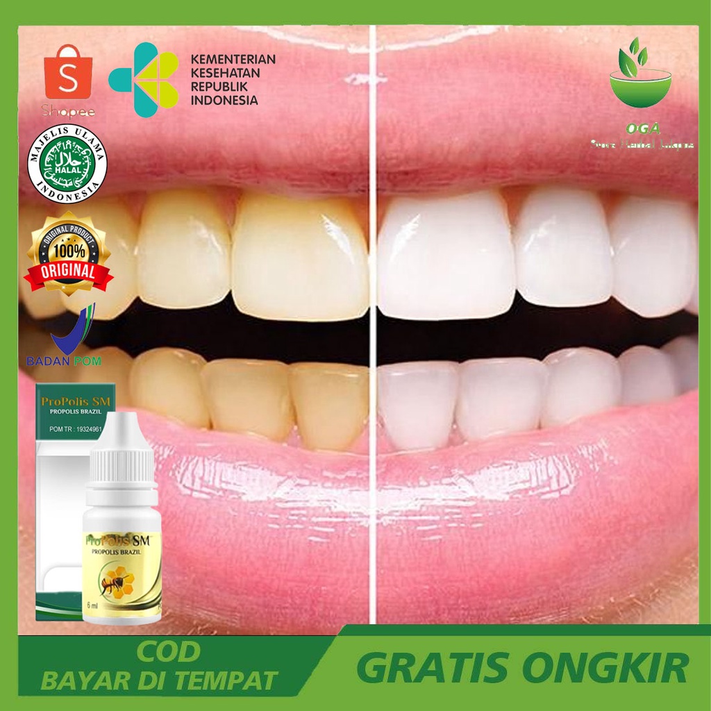 Obat Kumur gigi pemutih gigi menghilangkan tartar gigi membersihkan gigi kuning bau mulut